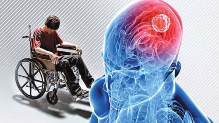 کلینیک تخصصی ذوبآهن برای بیماران اماس راهاندازی شد